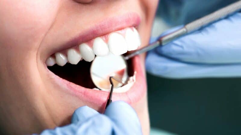 בקרב רופאי שיניים